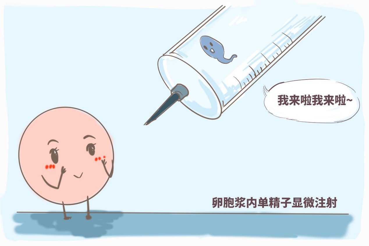 生殖医学：长沙捐卵价格调查
